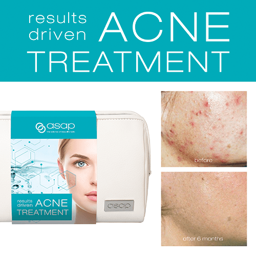 asap acne treatment pack AU | Adore Beauty